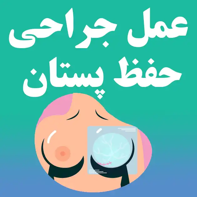 عمل جراحی حفظ پستان