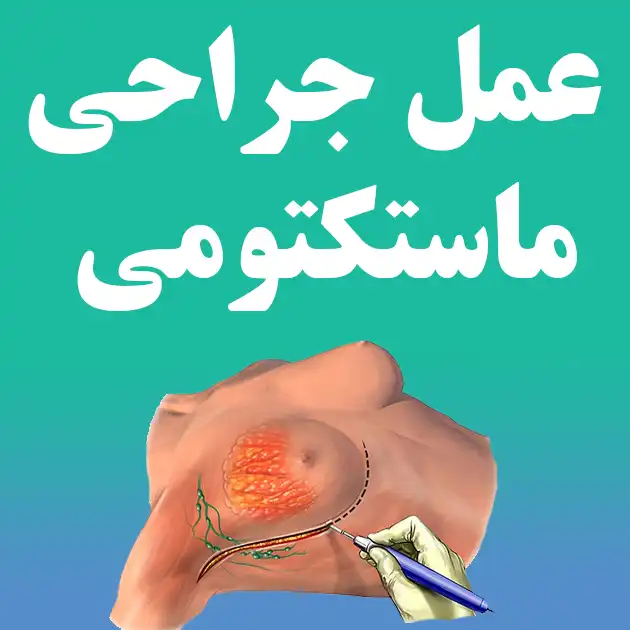 عمل جراحی ماستکتومی