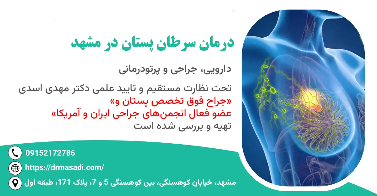درمان سرطان پستان در مشهد