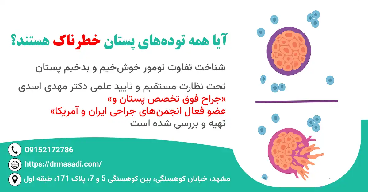 تفاوت توده خوش‌خیم و بدخیم پستان چیست؟ علائم، تشخیص