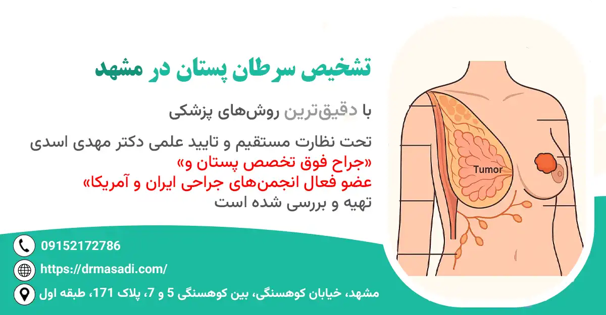 تشخیص سرطان پستان