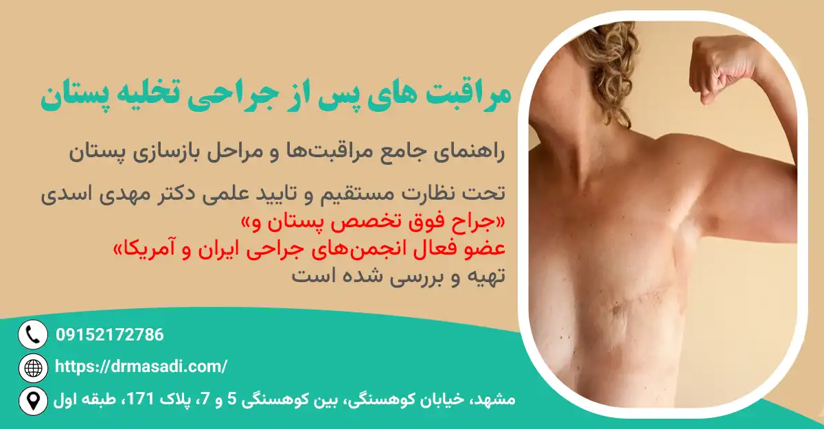 جراحی تخلیه پستان دکتر مهدی اسدی
