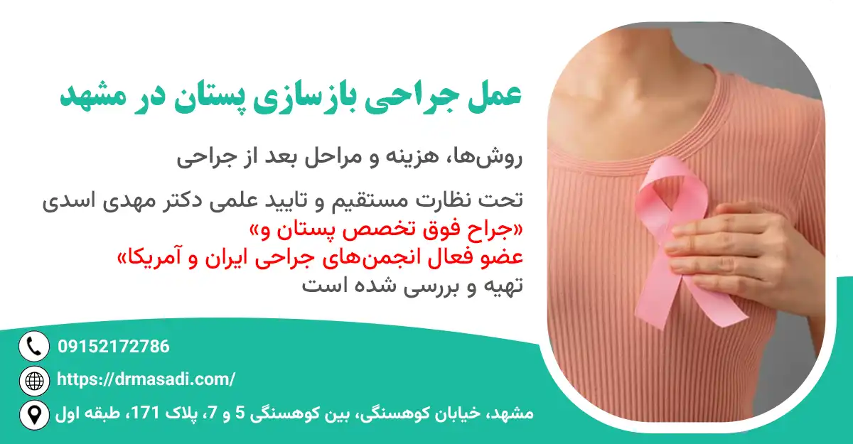 بازسازی پستان در مشهد