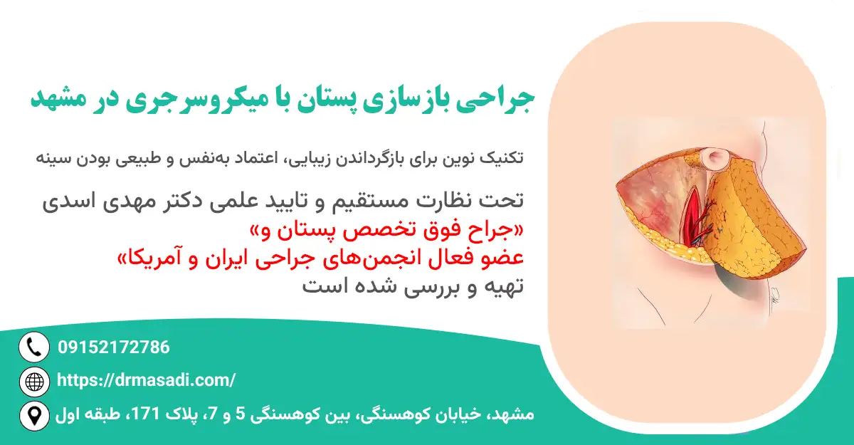 بازسازی پستان با میکروسرجری در مشهد