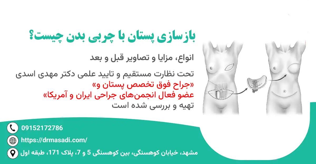 بازسازی پستان با چربی بدن