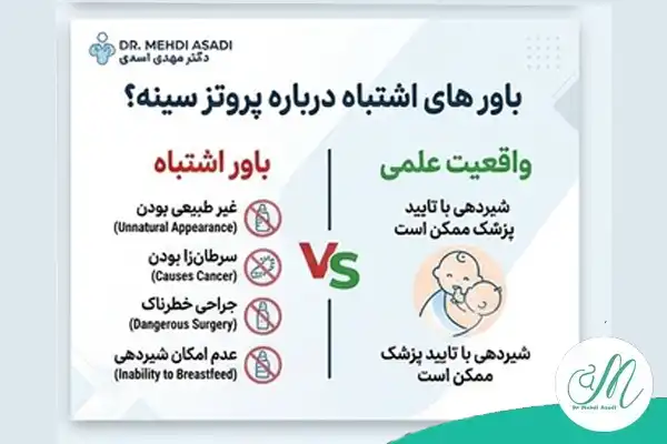 باورهای اشتباه درباره پروتز سینه