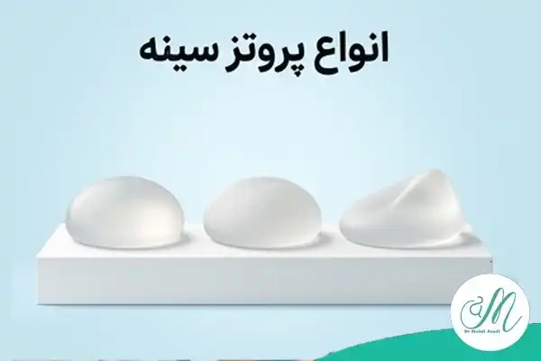 انواع پروتز سینه